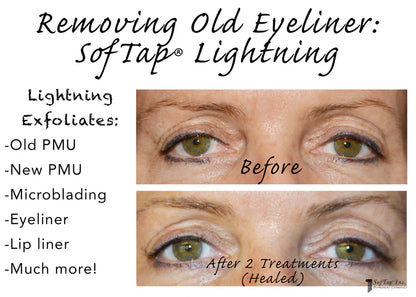 Lightning | Pigment Exfoliator