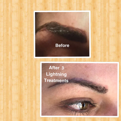 Lightning | Pigment Exfoliator